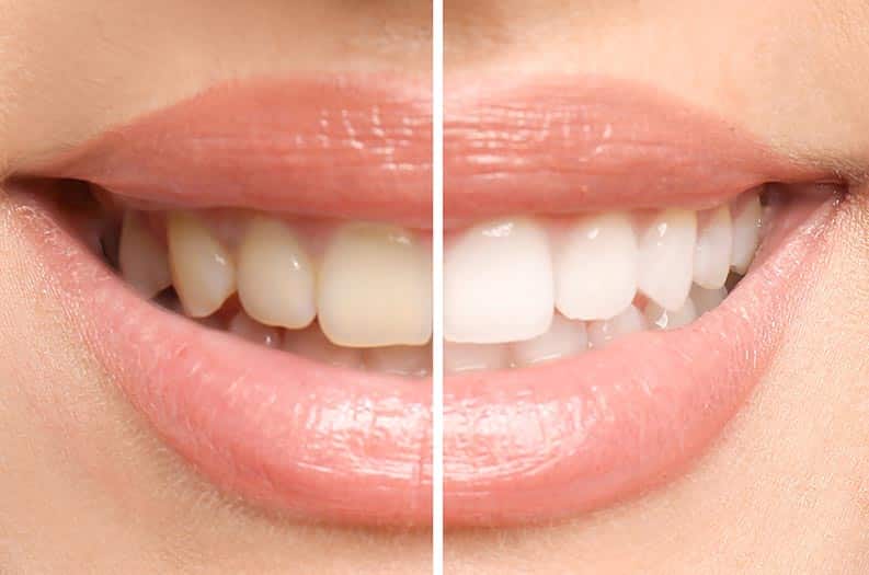 white smile holding a glass of water, showing the results of consistent, enamel-safe oral care without chemical bleach.