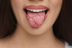 Toothpaste for Dry Mouth: What Actually Works for Daily Oral Comfort - Edinco