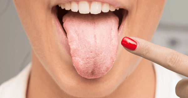 What’s Better for Oral Health: Oral Probiotics or Probiotic Toothpaste? - Edinco