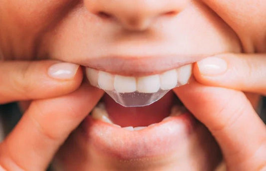 What’s More Effective for a Brighter Smile: Whitening Strips or Whitening Toothpaste? - Edinco